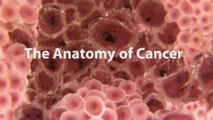 ANATOMY OF CANCER